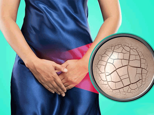 مراقبت های گام به گام واژن پس از زایمان+ انواع پارگی پرینه