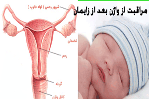 مراقبت های گام به گام واژن پس از زایمان+ انواع پارگی پرینه مراقبت های گام به گام واژن پس از زایمان+ انواع پارگی پرینه
