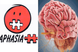 زبان پریشی یا آفازی چیست؟ + علل و انواع آن