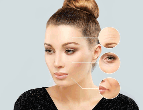 بوتاکس چیست؟ بوتاکس برای چه کسانی ممنوعه