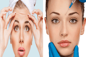 بوتاکس چیست؟ بوتاکس برای چه کسانی ممنوعه