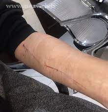 سه زن ایرانی که در فرودگاه استانبول کتک خوردند (عکس)