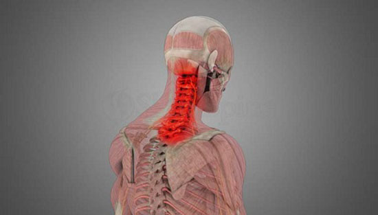 دلایل صدا دادن گردن و درد مفاصل گردن + درمان گردن درد