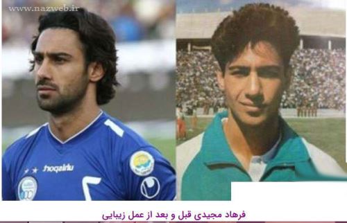 16 بازیگری که با جراحی زیبایی از این رو به اون رو شدند! + تصاویر