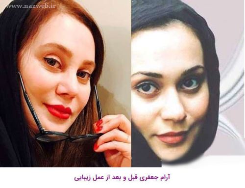16 بازیگری که با جراحی زیبایی از این رو به اون رو شدند! + تصاویر