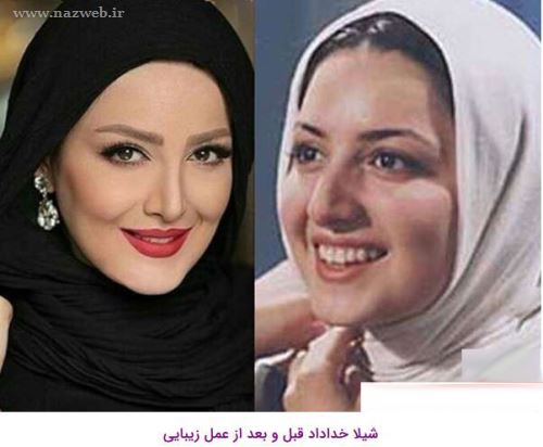 16 بازیگری که با جراحی زیبایی از این رو به اون رو شدند! + تصاویر