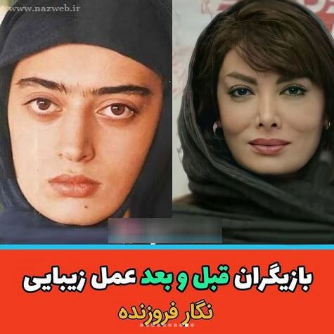 16 بازیگری که با جراحی زیبایی از این رو به اون رو شدند! + تصاویر