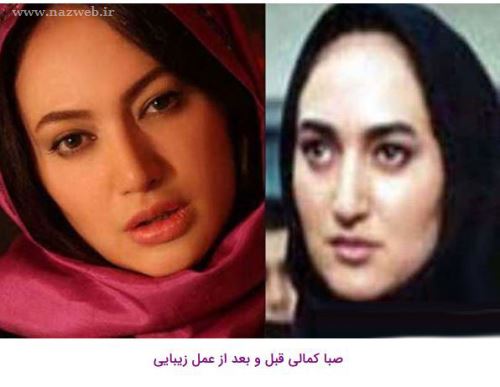 16 بازیگری که با جراحی زیبایی از این رو به اون رو شدند! + تصاویر