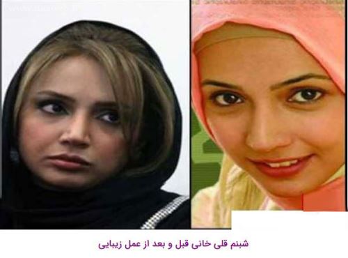 16 بازیگری که با جراحی زیبایی از این رو به اون رو شدند! + تصاویر