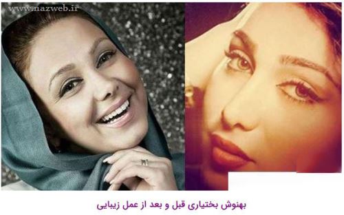 16 بازیگری که با جراحی زیبایی از این رو به اون رو شدند! + تصاویر