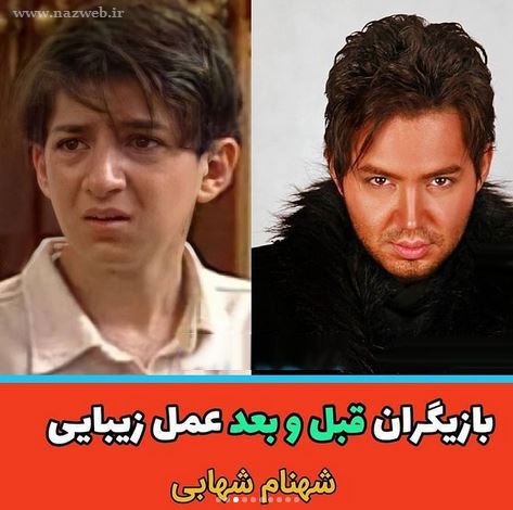 16 بازیگری که با جراحی زیبایی از این رو به اون رو شدند! + تصاویر