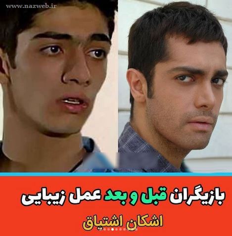 16 بازیگری که با جراحی زیبایی از این رو به اون رو شدند! + تصاویر