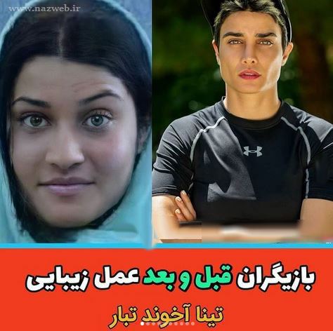 16 بازیگری که با جراحی زیبایی از این رو به اون رو شدند! + تصاویر