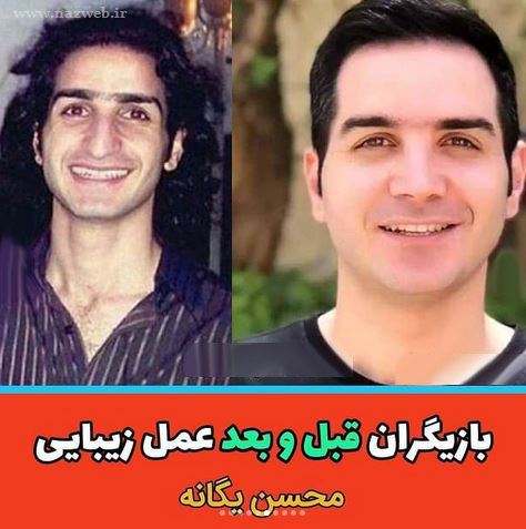 16 بازیگری که با جراحی زیبایی از این رو به اون رو شدند! + تصاویر