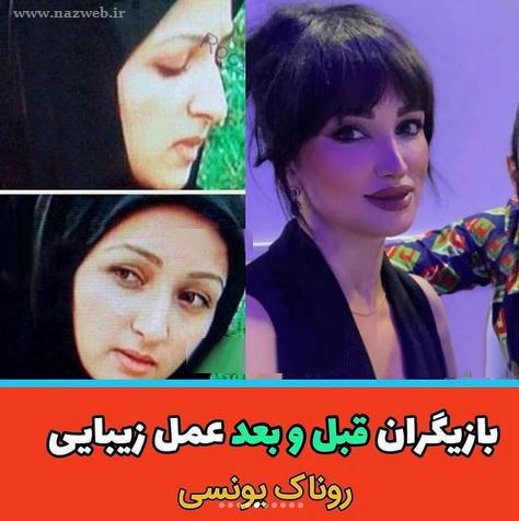 16 بازیگری که با جراحی زیبایی از این رو به اون رو شدند! + تصاویر