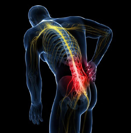 پارگی دیسک کمر و راه های درمان و علائم آن