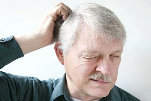 خارش سر نشانه شپش است؟ علت های خارش پوست سر