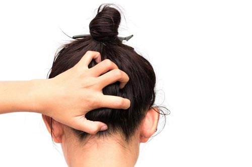 خارش سر نشانه شپش است؟ علت های خارش پوست سر