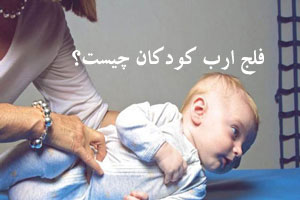 فلج ارب در کودکان چیست و چه علائمی دارد فلج ارب در کودکان چیست و چه علائمی دارد
