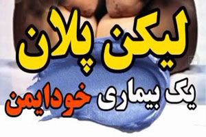 لیکن پلان پوستی بیماری جدید+ از دهان تا تناسلی لیکن پلان پوستی بیماری جدید+ از دهان تا تناسلی