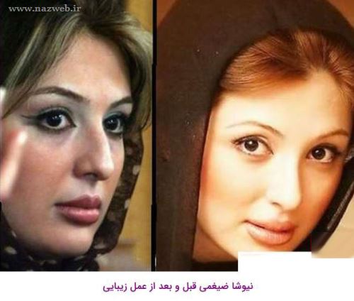 رکورد دختری با بیش از 10 عمل زیبایی (+عکس)