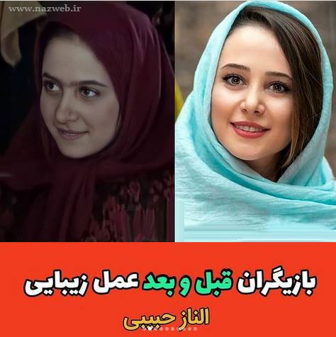 رکورد دختری با بیش از 10 عمل زیبایی (+عکس)