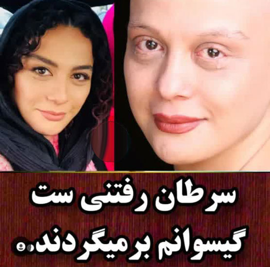 بیوگرافی جدید مونا فرجاد و چهره ی عجیبش بعد سرطان+ گالری عکس