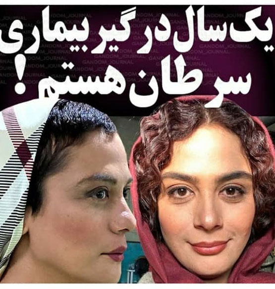 بیوگرافی جدید مونا فرجاد و چهره ی عجیبش بعد سرطان+ گالری عکس