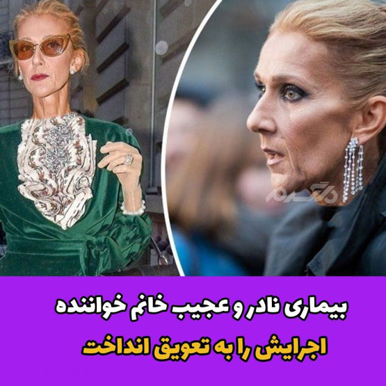 صدای سلین دیون خواننده جهان با Stiff person برای همیشه خاموش شد