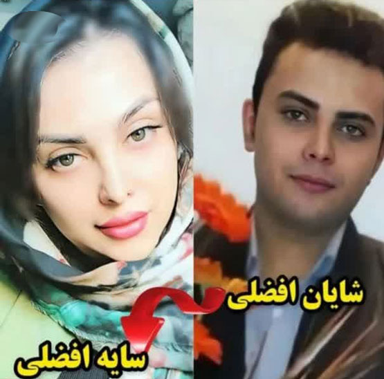 تصویر قبل و بعد ترنس دختر پسری به نام شایان که سایه شد!
