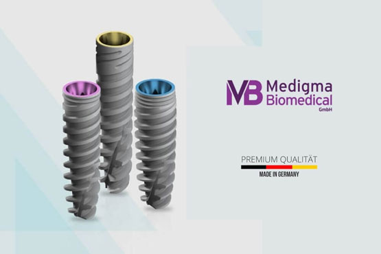  Medigma Implant: What Is It? How Does It Work? - German Made of Dental Implants 