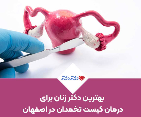 درمان کیست تخمدان در اصفهان توسط پزشک زنان خوب 