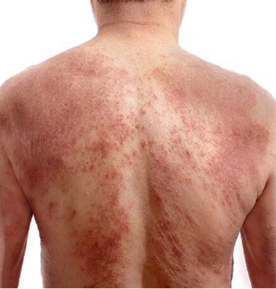بیماری سندرم و عکس ترانه علیدوستی بر خلاف میلش منتشر شد