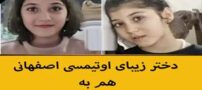 زیباترین دختر اوتیسم هم به آتش کشیدند| عکس و جزئیات