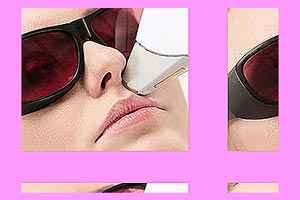 لیزر موهای زائد ایا خوب است یا بد؟ لیزر موهای زائد ایا خوب است یا بد؟