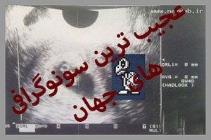 تصاویر دیدنی از عجیب ترین سونوگرافی های دنیا