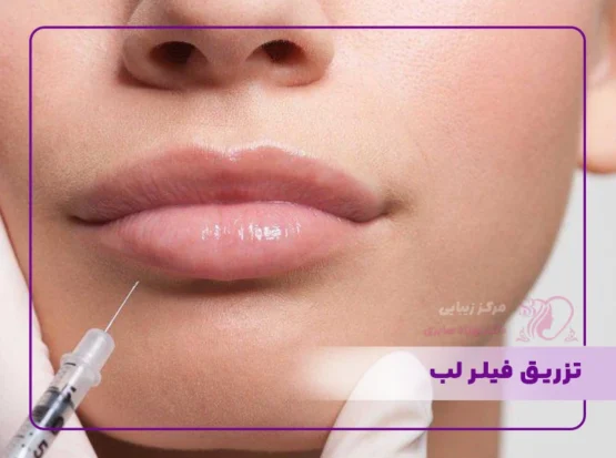 مرکز لیزر و زیبایی در سنندج | تجربه‌ای مطمئن با خدمات تخصصی