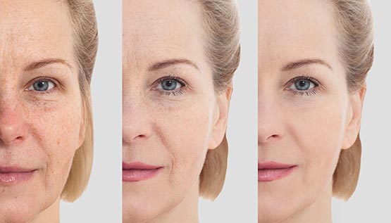 برای جوانسازی پوست صورت چکار کنیم