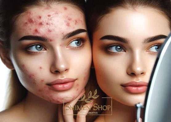 چرا ژل شستشوی صورت نسبت به صابون و فوم بهتر است؟