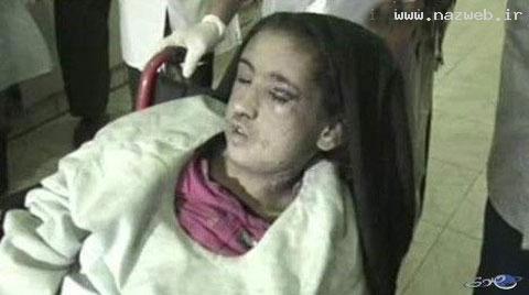 شکنجه دردناک نوعروس افغانی + عکس (16+)