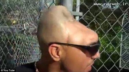 عکس های جنجالی مرد 25 ساله با نصف سر!!