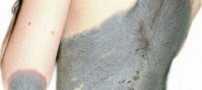 عکس دختری عجیب معروف به دختر گربه ای !!