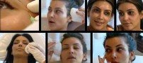 عکس های لورفته زن سرشناس در حال تزریق بوتاکس