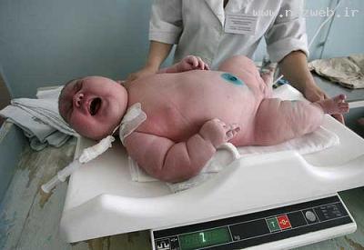 عکس های غول پیکرترین نوزاد 9 کیلویی در جهان
