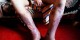 عکس های وحشتناک از مخدر کروکودیل ( 18+)