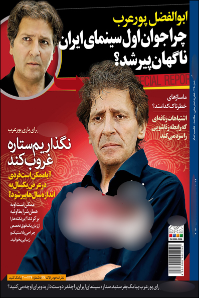 جراحی پلاستیک حال پورعرب را خوب میکند+ عکس