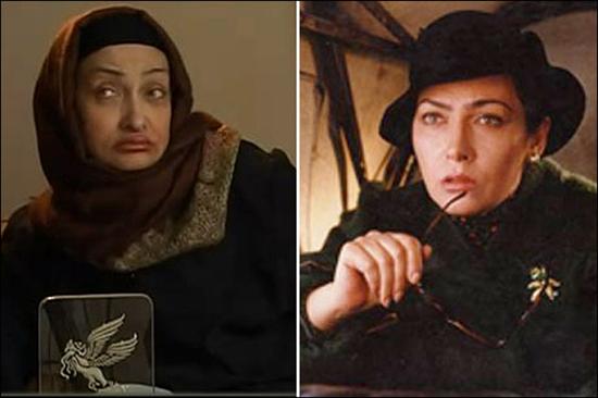 جراحی پلاستیک حال پورعرب را خوب میکند+ عکس