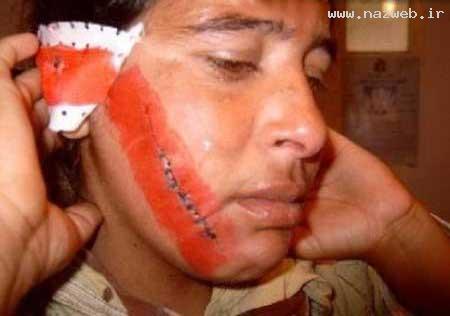 اقدام وحشتناک این مرد روی صورت همسرش! عکس