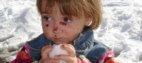 دختری با پوستی شکننده و پروانه ای! عکس