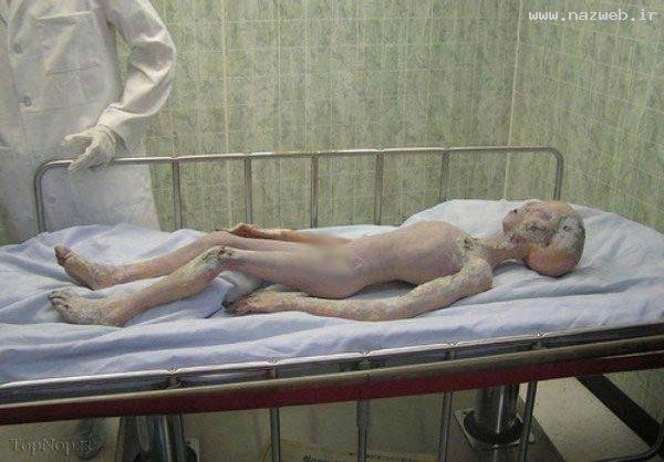 عکس های وحشتناک از بیگانگان مرده در جهان!! 16+